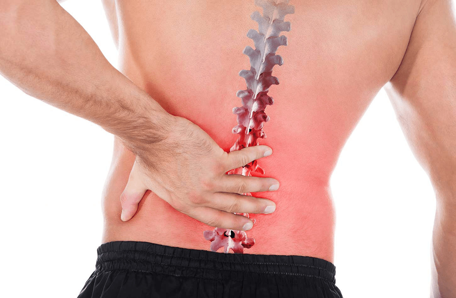 Want to avoid surgery for an L45 or L5S1 herniated disc?